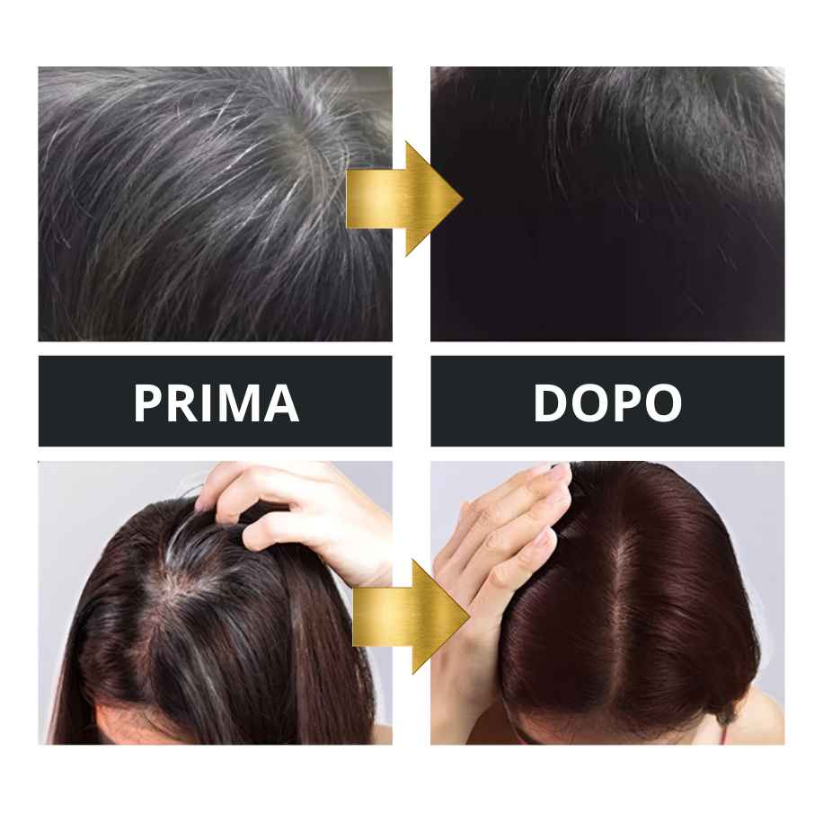 Hozho™ Copri Capelli Bianchi Istantaneo Hozho